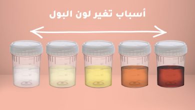 تغير لون البول